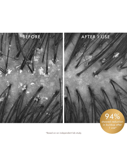 Purifying Pre-Wash Scalp Scrub